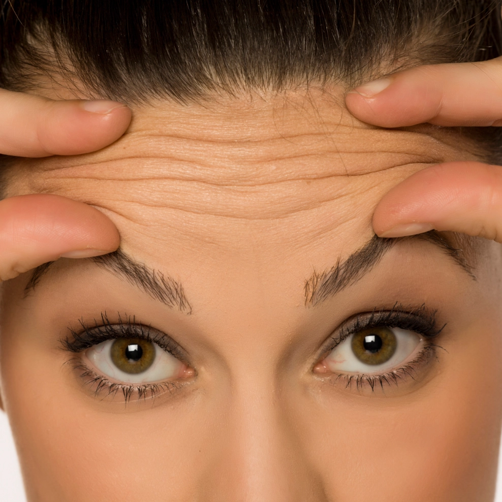 uucp-botox-3