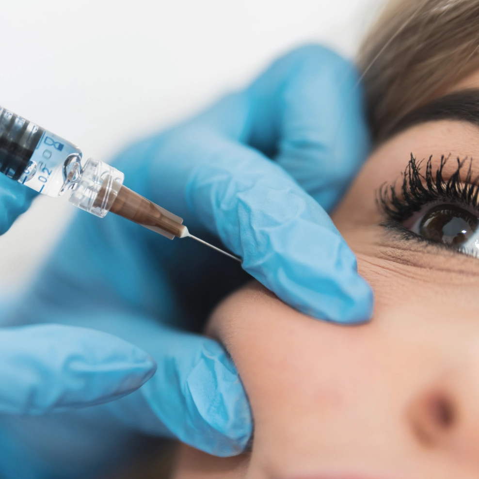 uucp-mid-face-filler-3